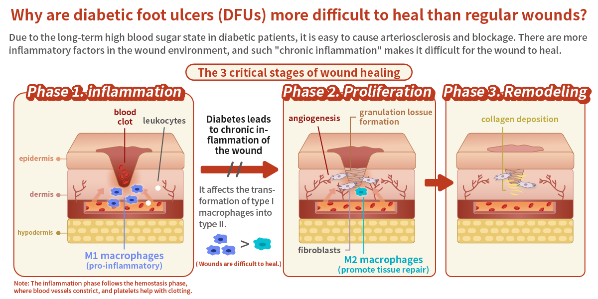 Why are diabetic foot ulcers (DFUs) more difficult to heal than regular wounds?