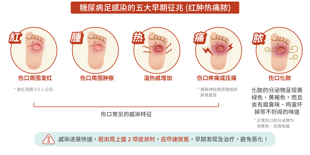 糖尿病足感染的五大早期征兆(红肿热痛脓)