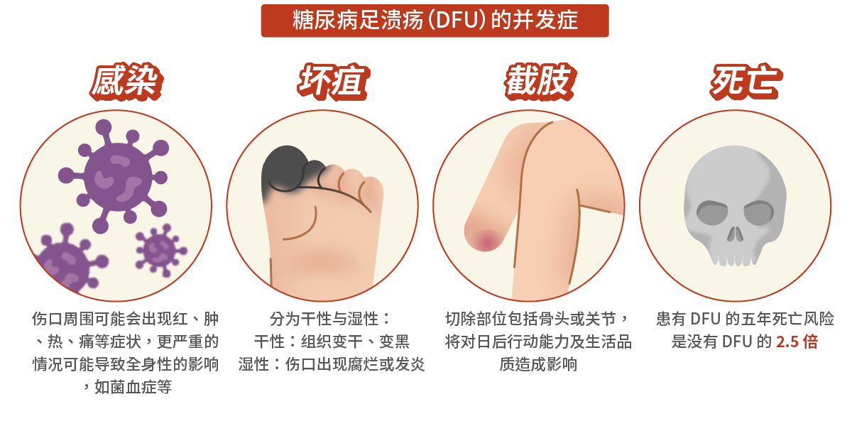 糖尿病足溃疡(DFU)的并发症