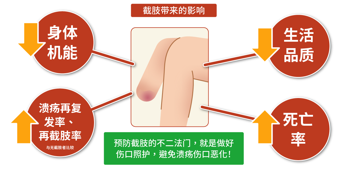 截肢带来的影响