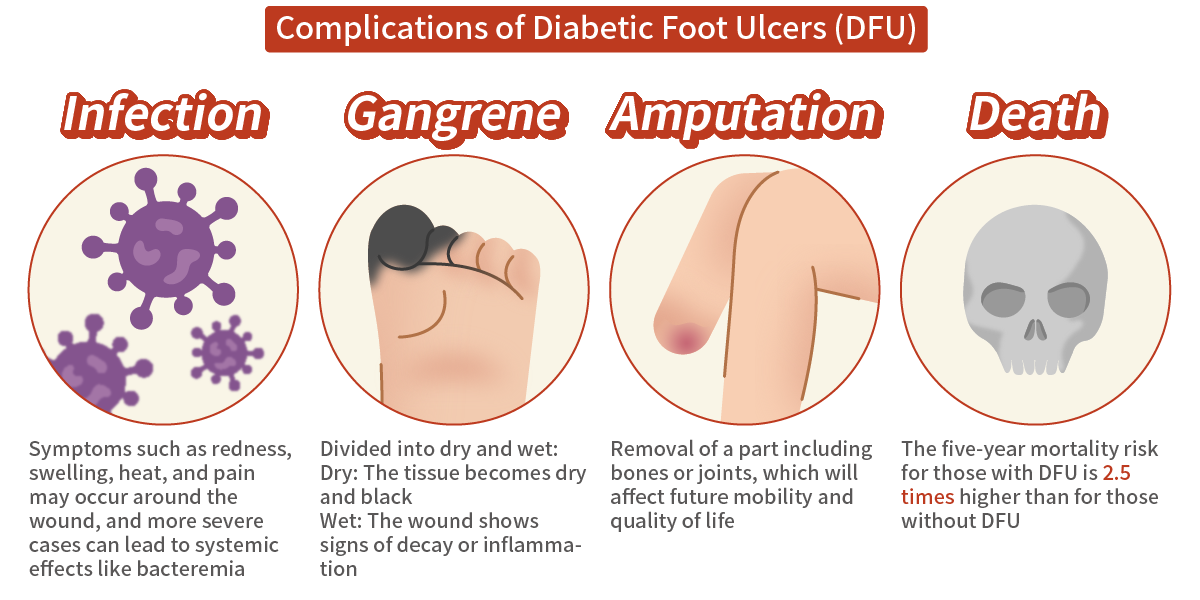 Complications of Diabetic Foot Ulcers (DFU)