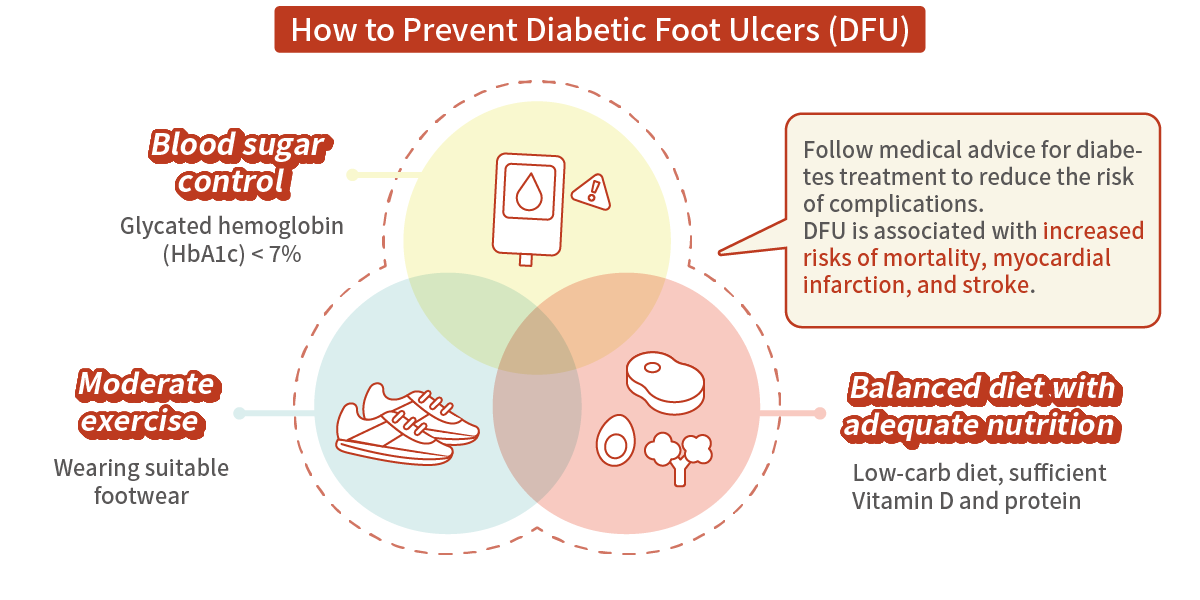 How to Prevent Diabetic Foot Ulcers (DFU)
