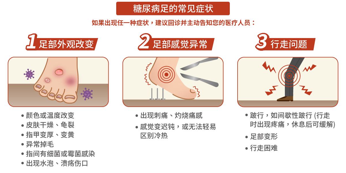 糖尿病足的常见症状