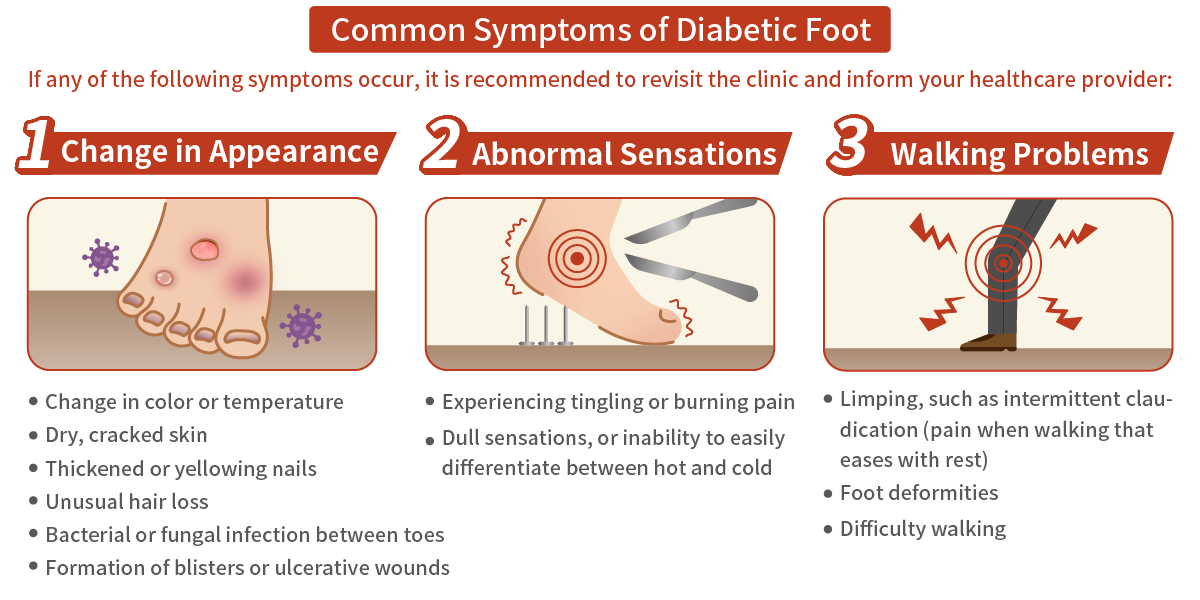 Common Symptoms of Diabetic Foot