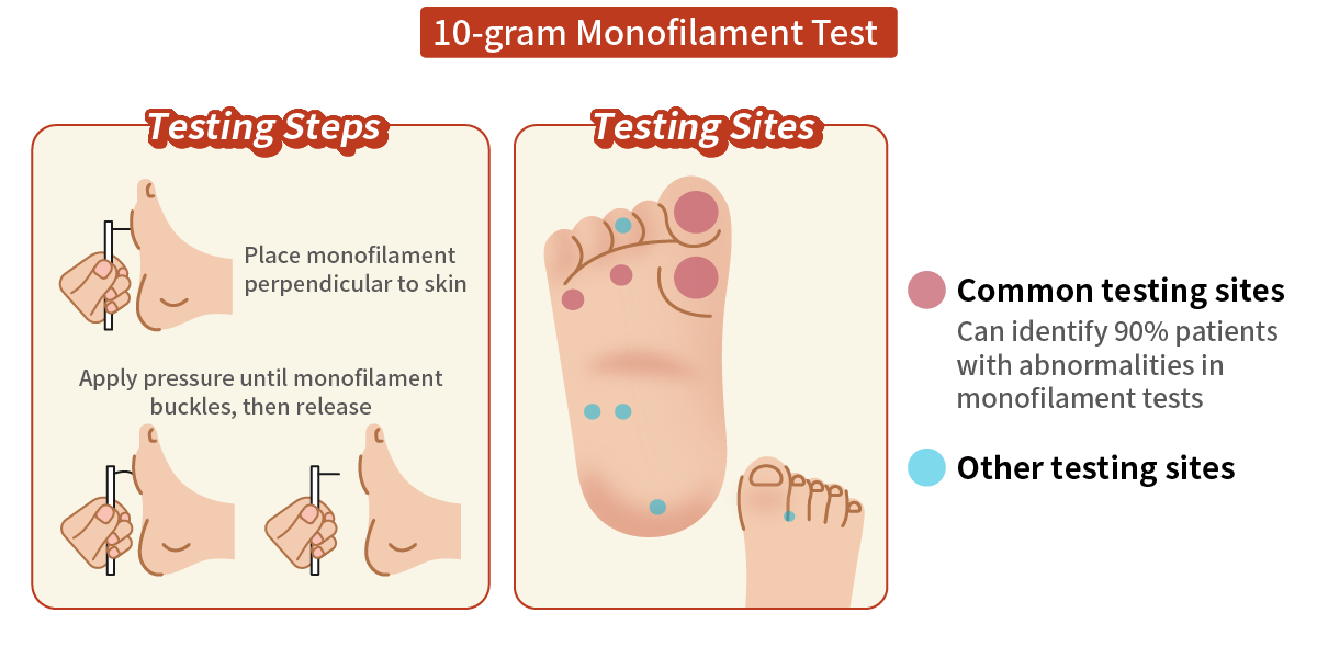 10-gram Monofilament Test